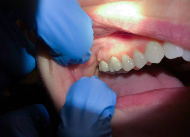 Best Tooth Pain Emergency Relief  in Antioch, IL